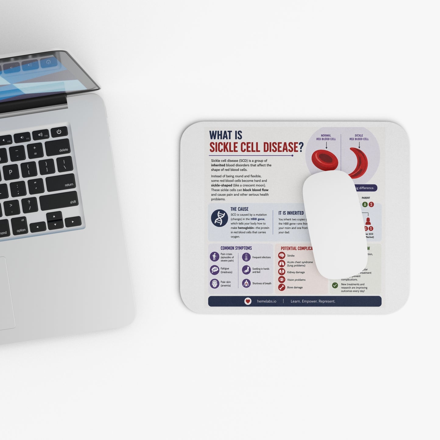 What is Sickle Cell? - Mousepad