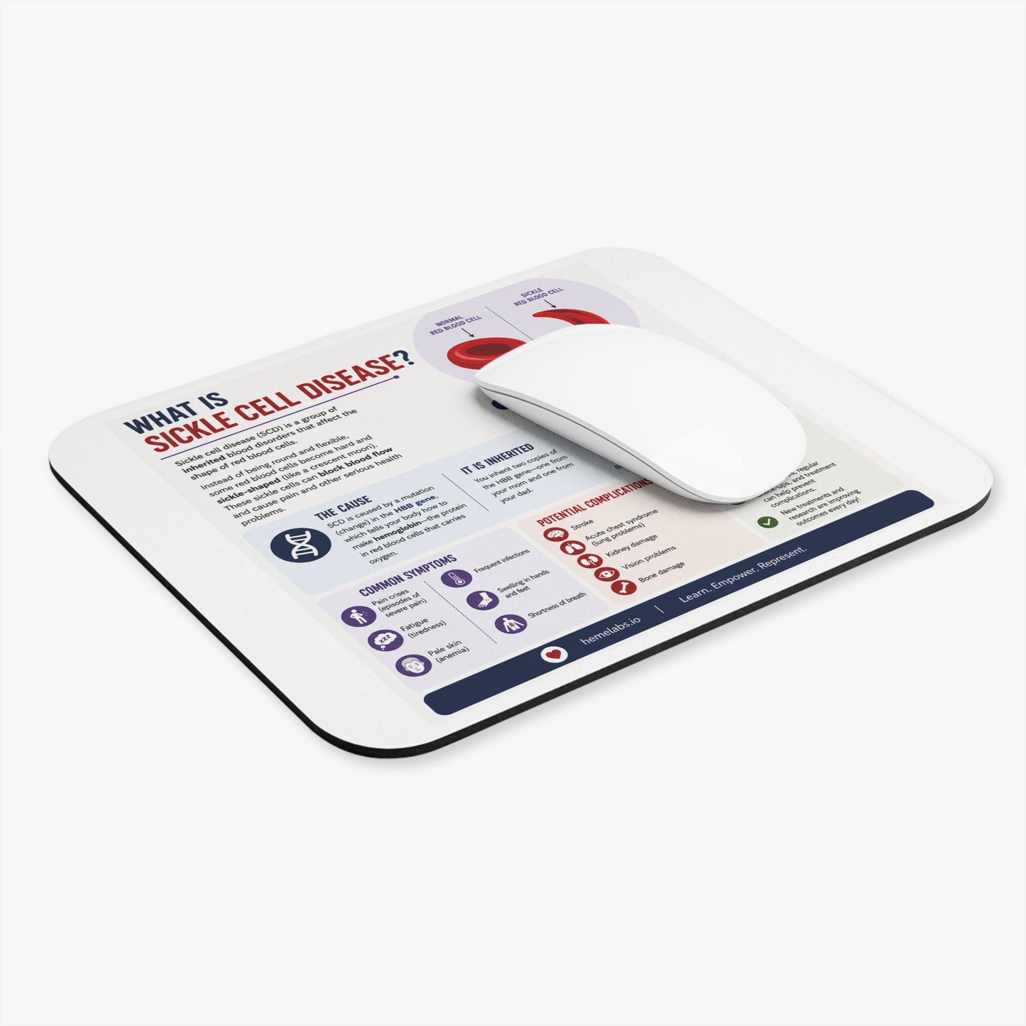 What is Sickle Cell? - Mousepad